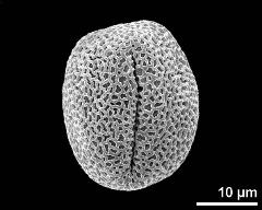 equatorial view (3-colpate pollen grain)