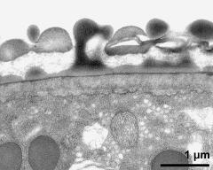 pollen wall; interapertural area