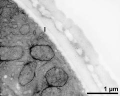 interapertural area of pollen wall