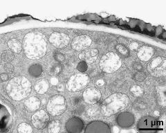 pollen wall at transition of aperture and interapertural area