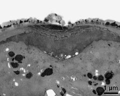 apertural area of pollen wall