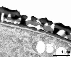 interapertural area of pollen wall