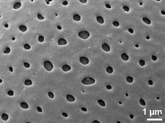 exine surface