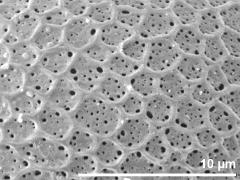 exine surface
