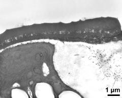 pollen wall at transition of aperture and interapertural area