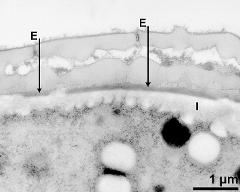 interapertural area of pollen wall, intine (I), endexine (E)