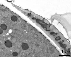 pollen wall at transition of aperture and interapertural area