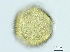 acetolyzed pollen,polar view