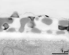 interapertural area of pollen wall