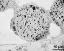 pollen grain in cross section