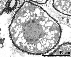 cross section of microspore