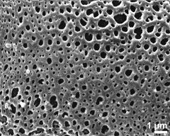 exine surface