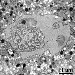 generative cell (left) and vegetative nucleus