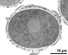 cross section of pollen grain