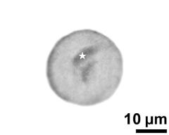 generative cell (asterisk) and vegetative nucleus