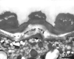 apertural area of pollen wall