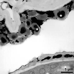 pollen wall and tapetum cells with Ubisch bodies (asterisks)