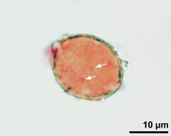 pollen grain with sperm cells (arrows)