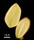 acetolyzed pollen,equatorial view