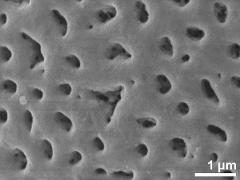 acetolyzed pollen,exine surface