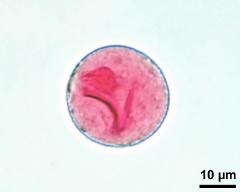 pollen grain with vegetative nucleus and sperm cells