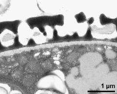 pollen wall; interapertural area