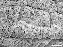 tetrads (forming massula)