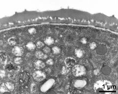 pollen wall, interapertural area