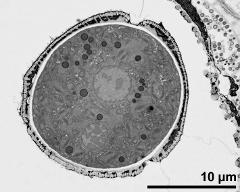 cross section of pollen grain, and Ubisch bodies on loculus wall