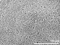 exine surface