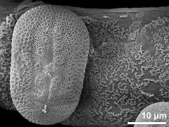 anther wall with Ubisch bodies and pollen grain (equatorial view)