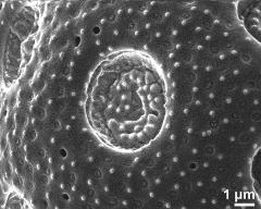 aperture of dry pollen grain