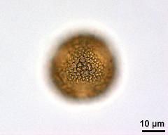 acetolyzed pollen,polar view,upper focus