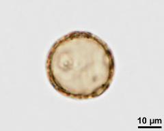 acetolysed pollen, lower focus