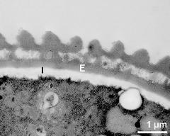 interapertural area of pollen wall, intine (I), endexine (E)