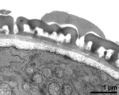 pollen wall; interapertural area; compact endexine clearly visible (electron-dense) with modified Thiéry-test