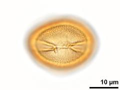 acetolyzed pollen,equatorial view