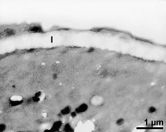 apertural area of pollen wall