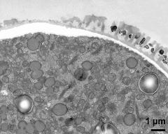 pollen wall at transition of aperture and interapertural area