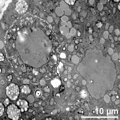 generative cell (left) and vegetative nucleus