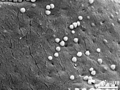 exine surface (equator)