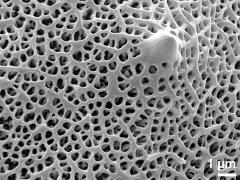 exine surface