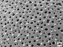 exine surface