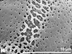 exine surface (equatorial area)