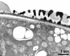 pollen wall at transition of aperture and interapertural area