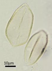 acetolyzed pollen,equatorial view