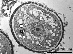 pollen wall, transition from aperture to interapertural area