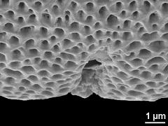 acetolyzed pollen,aperture