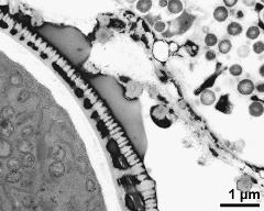 pollen wall, interapertural area; pollenkitt and Ubisch bodies