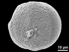 polar proximal view